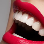 odontoiatria_cosmetica